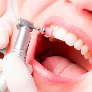 Професійна гігієна